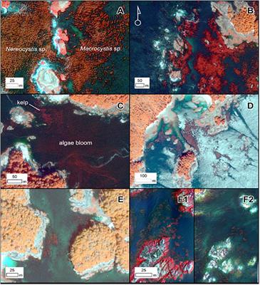 A Review of the Opportunities and Challenges for Using Remote Sensing for Management of Surface-Canopy Forming Kelps